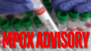 ﻿Union health ministry issues Mpox advisory amid global health concerns